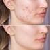 Крем для лица против пигментации CARE:NEL Anti-Melasma Cica Cream фото-6